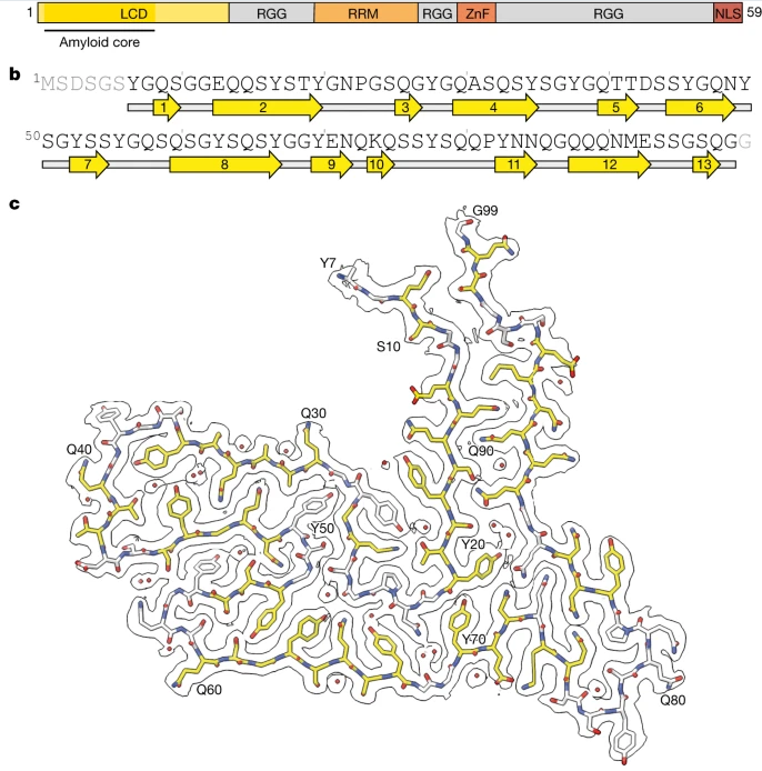 Nature：科學家識別出與人類額顳葉癡呆癥發(fā)生相關的新型蛋白質